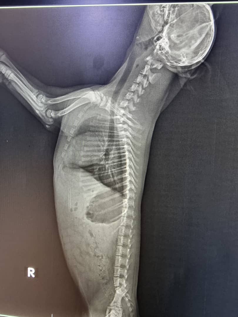 Lateral Whole-Body X-Ray